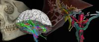 3D images of head, brain, and liver anatomy.